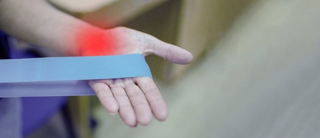 Carpal Tunnel Syndrome