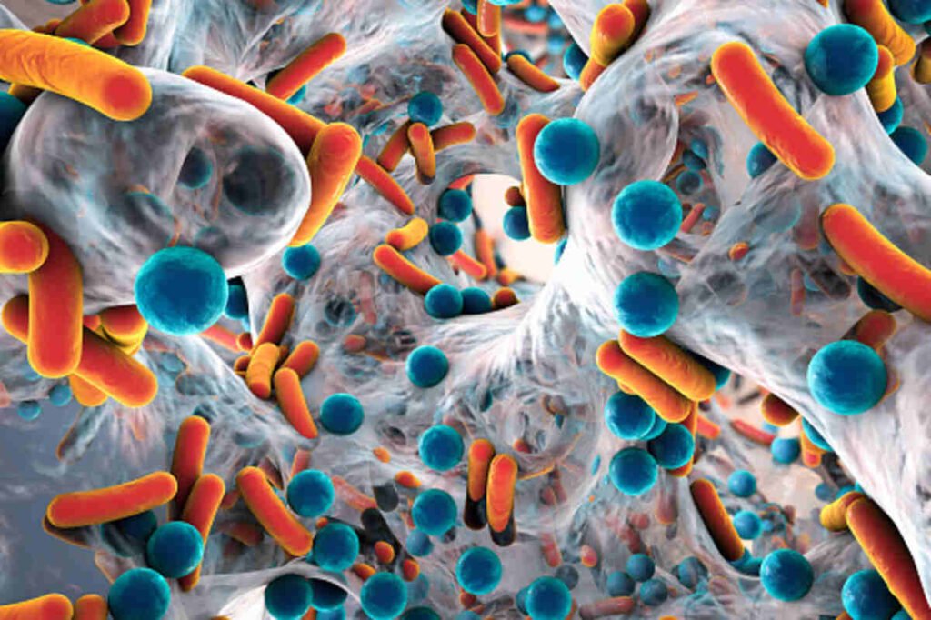 What is MRSA?