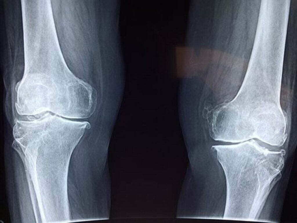 Having an Orthopedic Surgery? Suggestions to Select Your Surgeon