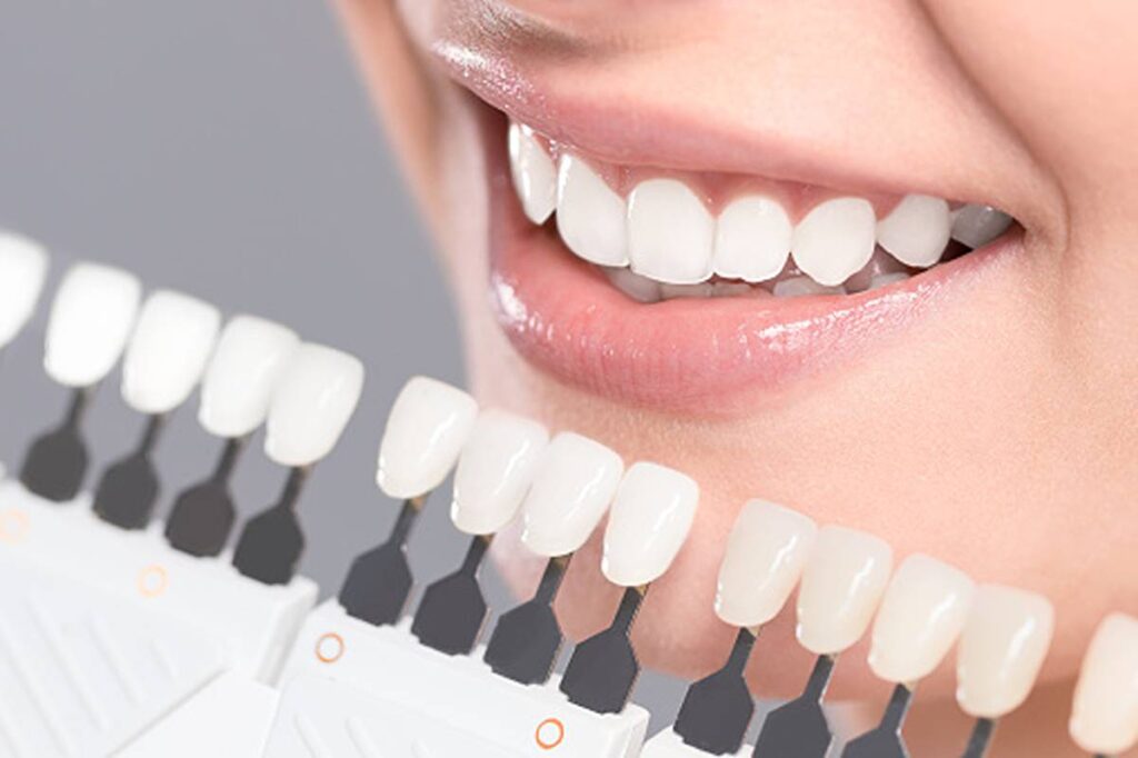 Snow Tooth Whitening Tutorial Overview