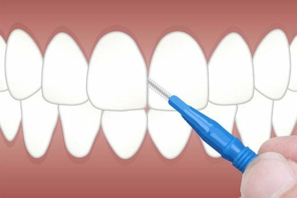 Bright Now Dental Reviews